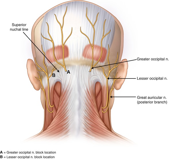 Pain In Back of Head