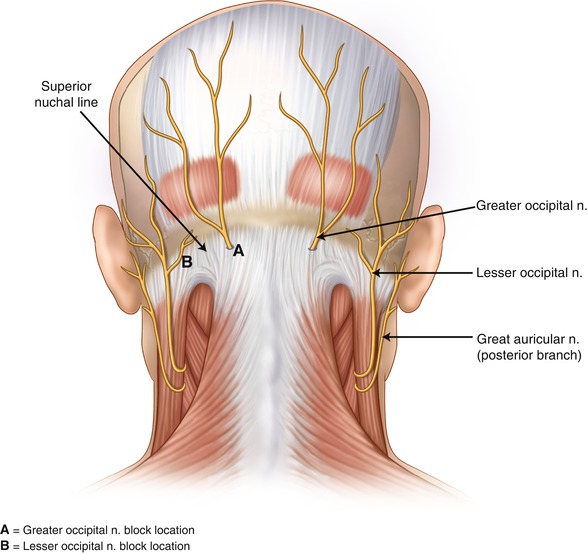 Headache and neck pain: is it possible that nerve compression is