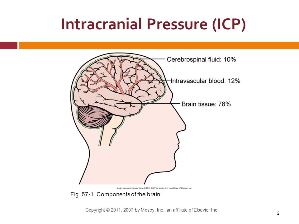 Migraine Canada Intracranial Hypertension Or Pseudotumor Cerebri Basics