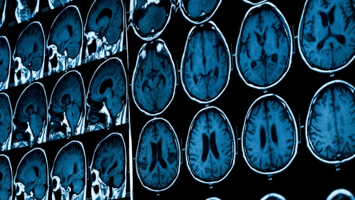 Should I Be Concerned If My Physician Didn&rsquo;t Prescribe Imaging for Migraine?