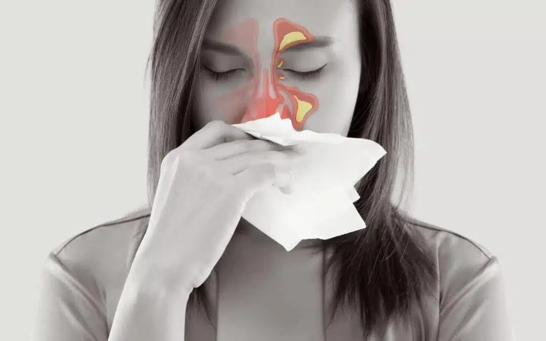 Deciphering Sinus Headaches: Migraine vs. Sinusitis