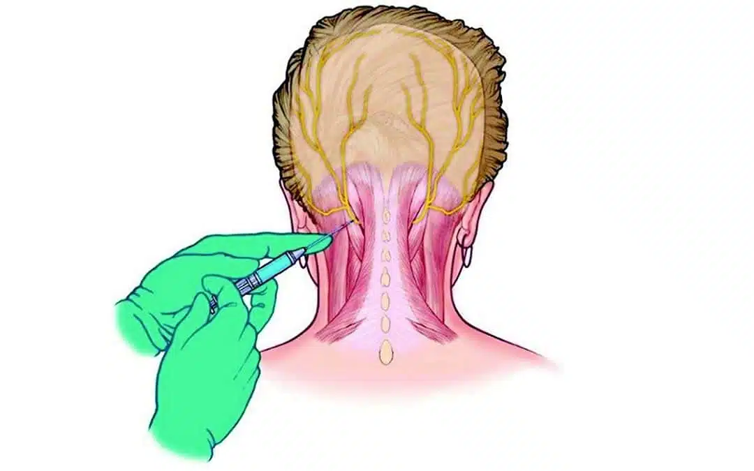 Nerve Blocks Anatomy: Understanding the Connections