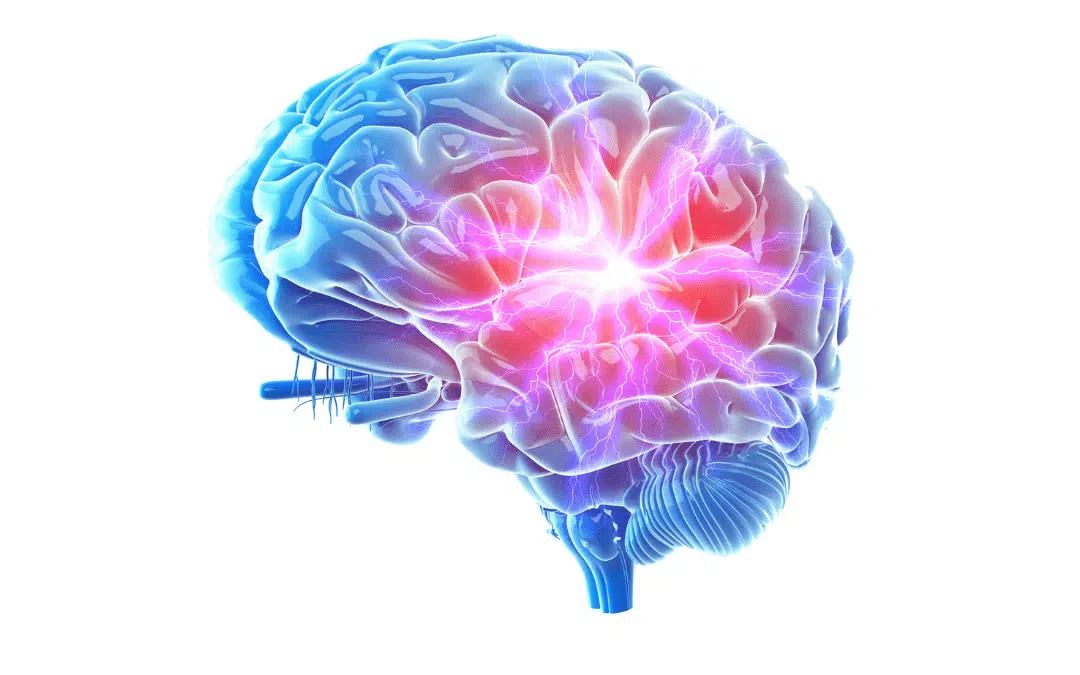 Post 007 -The cause of migraine: