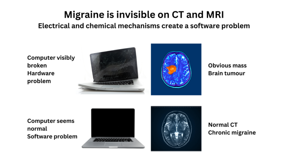 The Cause of Migraine: The Electrical and Chemical Sides of Migraine ...