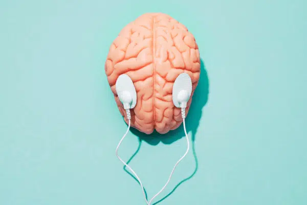 Image of brain being electrostimulated