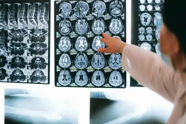 Doctor examining images of a brain